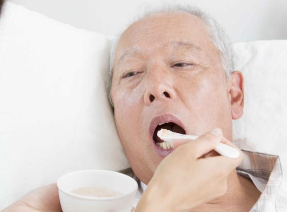 脑梗隐秘信号大揭秘:300例解剖背后的共同危险因素
