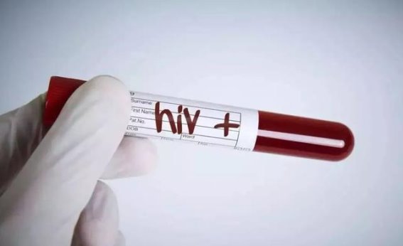 艾滋病隐性传播风险:如何在日常生活中守护健康