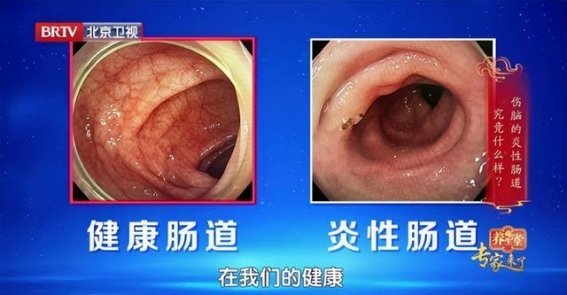 便秘可能加速老年痴呆!护肠食谱助你通便护脑